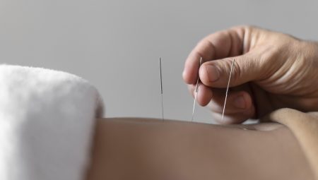 Akupunktur Ile Sağlıklı Kilo Verme: Vücut Ve Zihin Uyumunu Sağlamak